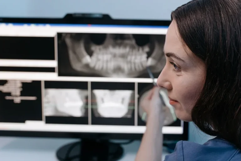 How AI Detects Cavities in Dental X-Rays, Explained